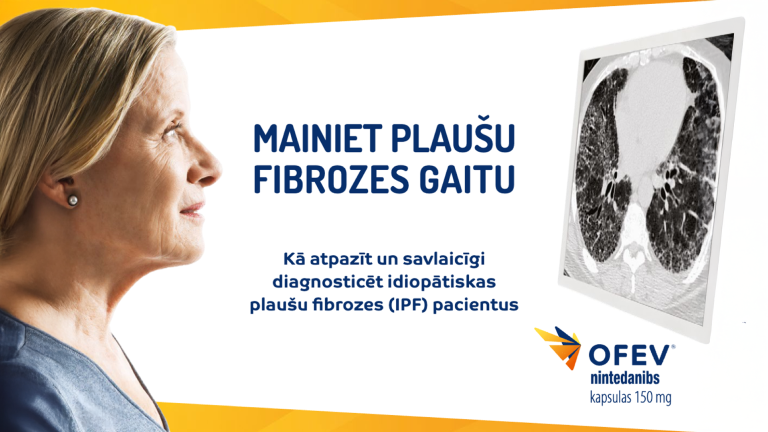 Kā atpazīt un savlaicīgi diagnosticēt IPF