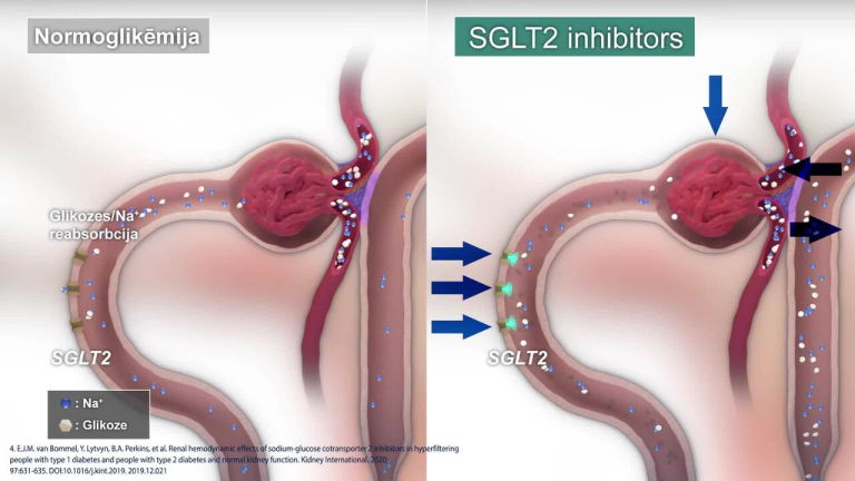 SGLT2i darbības mehānisms